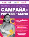 DIF Matamoros lanza campaña de prótesis de mano gratuitas: Una oportunidad para transformar vidas
